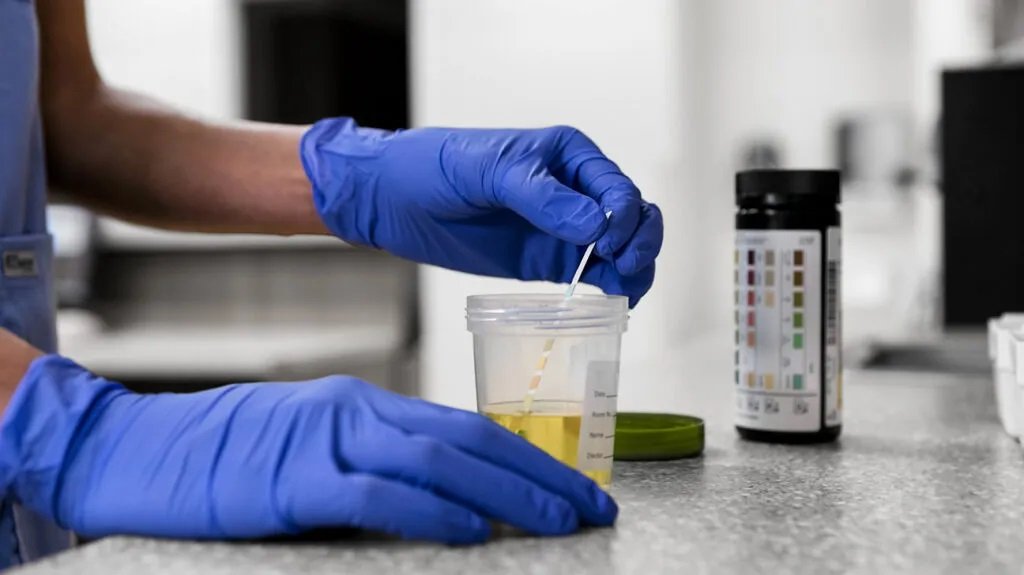 Drug Health Screening